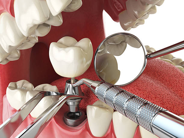 Best Emergency Orthodontic Repairs in Griffith, IN