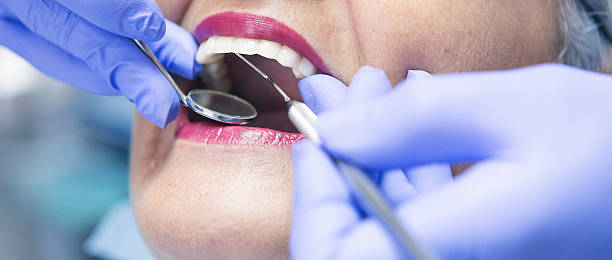 Best Emergency Root Canal Treatment in Griffith, IN